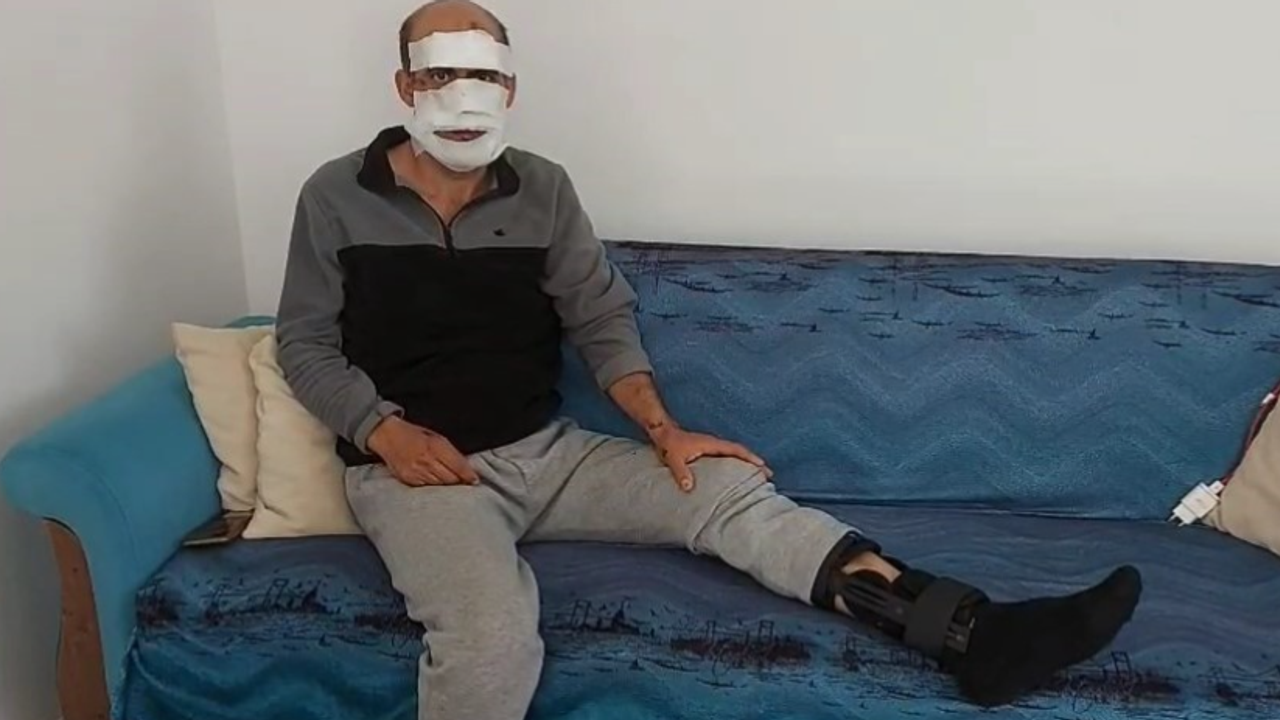 Eniştesine araçla çarpıp kaçtı: O anlar kameraya yansıdı