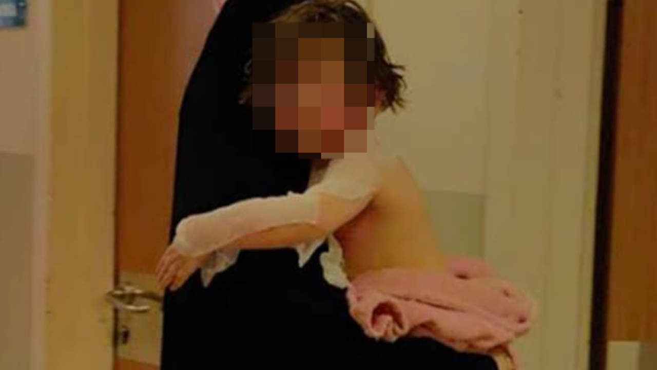 Çaydanlık devrildi...  3 yaşındaki çocuk yandı
