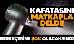 Kafatasını matkapla deldi, ölümden döndü!