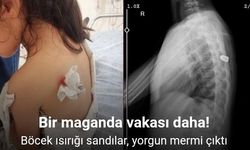 Böcek ısırığı sandılar, yorgun mermi çıktı