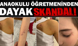 Anaokulunda öğretmenden dayak skandalı!