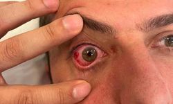 Eyüpspor: "Uğur Demirok’un gözünden ameliyat olma ihtimali bulunuyor"