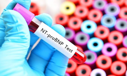 BNP veya NT- proBNP testi