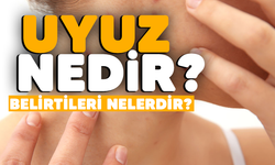 Uyuz hastalığı nedir? Nasıl korunulur?