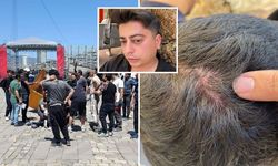 İzmir'de İHA ekibine çirkin saldırı! Özgür Özel'in boykot çağrısı can yaktı