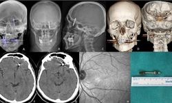 Bursa'da beynine saplanan implant hayatını kararttı: 2 yıldır adalet bekliyor