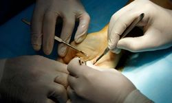 El cerrahisinde yeni dönem!