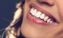 Hollywood gülüşü ilgi topluyor