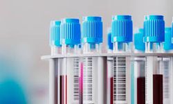 Dünyada yalnızca 50 kişide var! 'Altın kan' tıp tarihine damga vuracak