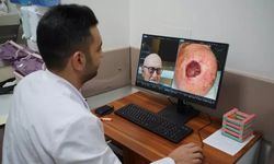 Saçlı derideki nadir tümör Sakarya’da tedavi edildi