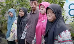 Dünya onları konuşuyor! "Kertenkele Ailesi" kısa sürede fenomen oldu