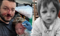 Yalova’da baba ve 14 aylık kızına scotter ile saldıran zanlının 36 yıla kadar hapsi istendi