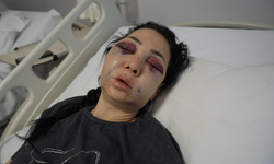 Oğlunun gözü önünde anneyi öldüresiye dövdüler: Yüzü tanınmaz halde