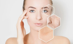 Hassas ciltlere kurtarıcı dokunuş: Cilt bariyerini destekleyen etkili 7 yöntem