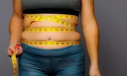 Obezite ameliyatında kalıcı başarı için yaşam tarzı şart