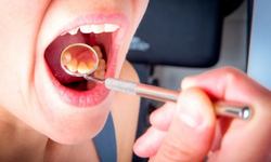 Uzmanlar uyardı: Damak şişliği hafife alınmamalı