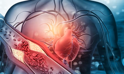 Kolesterolün fazlası felce davetiye çıkarıyor