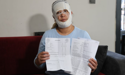 Güzelleşmek uğruna gittiği merkezde yüzü yandı