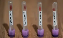 Sağlık Bakanlığı'ndan açıklama geldi! Türkiye'de hantavirüs görüldü mü?