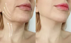 Ünlü estetikçi açıkladı: "Yüz gençleştirme ameliyatları ile 30 yıl gençleşmek mümkün"