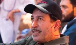 "Frank işareti tek başına kalp hastalığı belirtisi değildir"