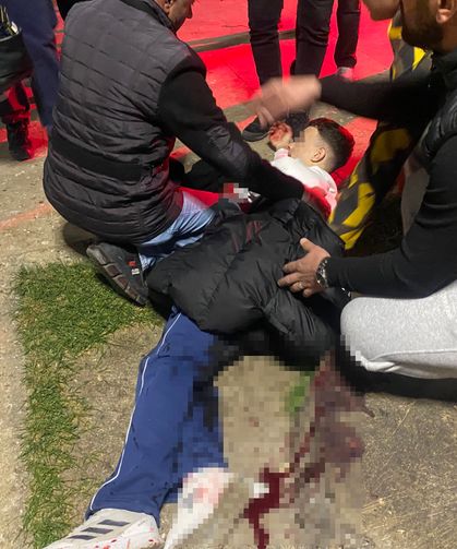 Bursa’da parkta bıçaklı kavga: 16 yaşındaki çocuk yaralandı