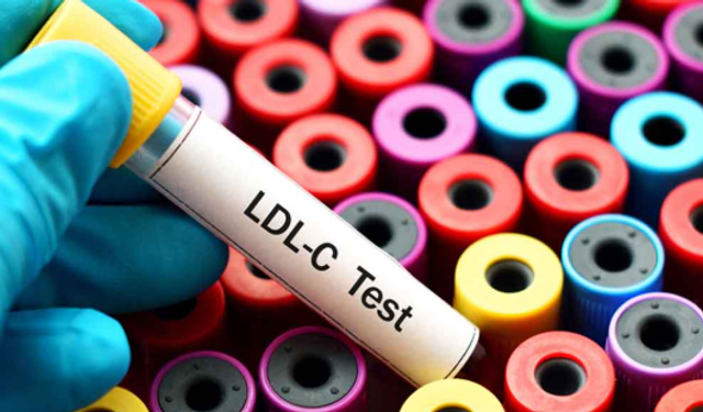 LDL (Kötü) Kolesterol Nedir?