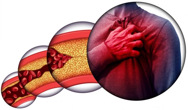 Dahiliye uzmanı uyardı: Kolesterol kontrollerinizi ihmal etmeyin