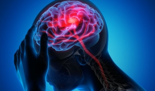 Prof. Dr. Demir, beyin sisi hastalığı hakkında bilgi verdi