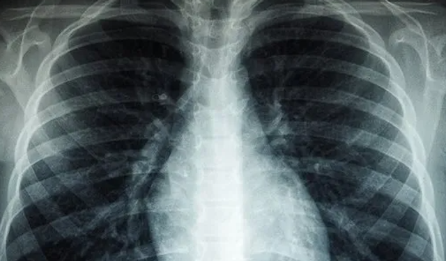 Basit gibi görünen semptomlar, kanserin habercisi olabilir