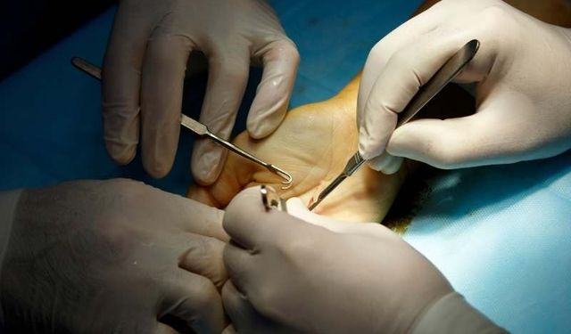 El cerrahisinde yeni dönem!