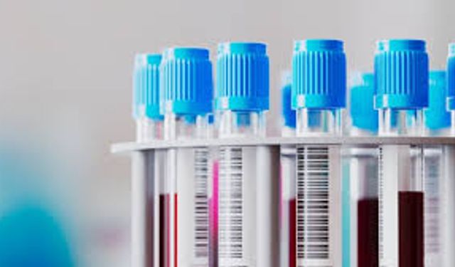 Dünyada yalnızca 50 kişide var! 'Altın kan' tıp tarihine damga vuracak