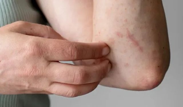 Besin tüketiminden sonra ilk 90 dakikaya dikkat