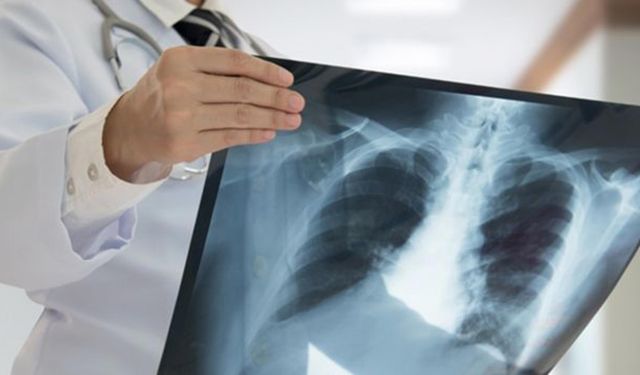 Verem hala ölümcül olabilir