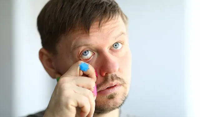 Göz tansiyonu kalıcı görme kaybına yol açabiliyor