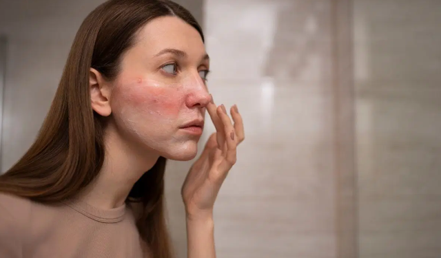 Asitli serumları kullanırken dikkat: Farkında olmadan cilde zarar veriyor...