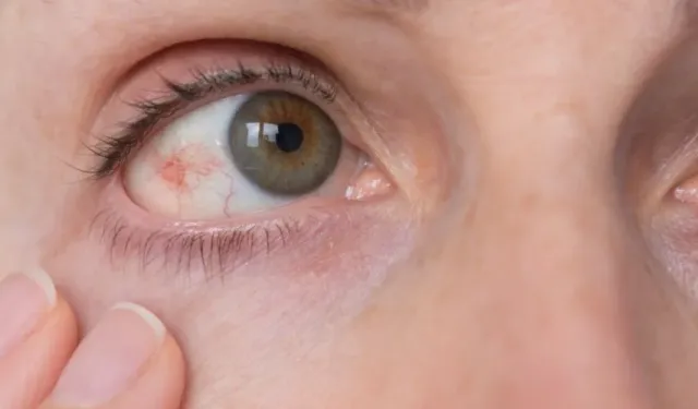 Glokom sinsi ilerliyor: Erken tanı görmeyi kurtarabilir