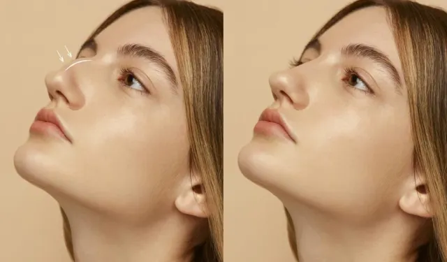 KBB uzmanından burun estetiğinde kişiye özel tasarım vurgusu