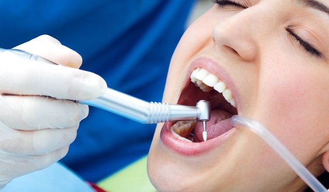 İnegöl Güleryüz Ağız ve Diş Sağlığı Polikliniği Bilgilendiriyor Diş Taşı Temizliği Dişlere Zarar Verir mi?