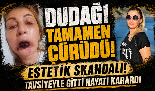 Estetik işlem sonrası dudağı çürüdü, 7 yıldır hukuk mücadelesi veriyor