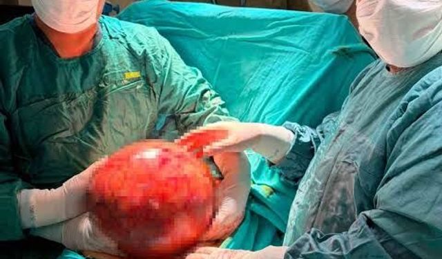 Doktorlar gözlerine inanamadı: 1,5 yıl ertelediği ameliyatta karnından dev kitle çıktı