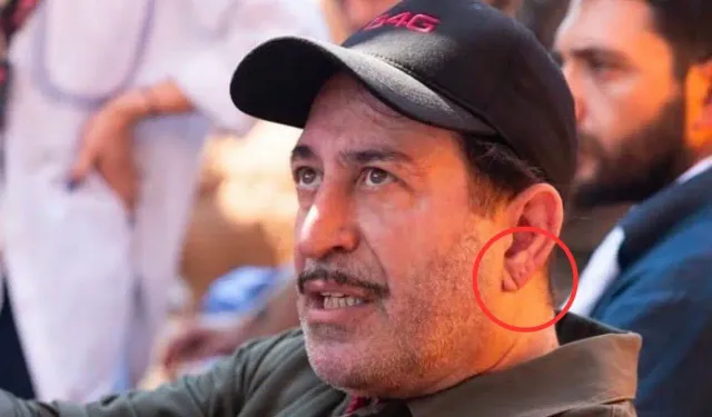 "Frank işareti tek başına kalp hastalığı belirtisi değildir"
