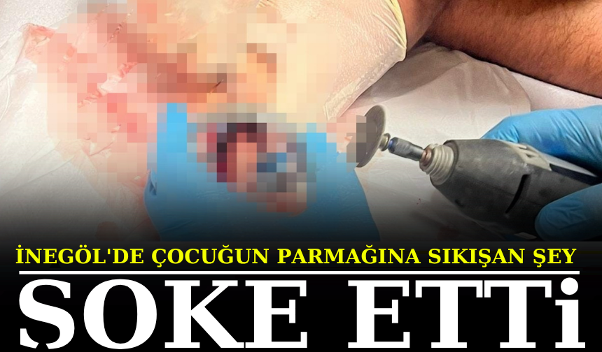 İnegöl'de çocuğun parmağına sıkışan şey şoke etti