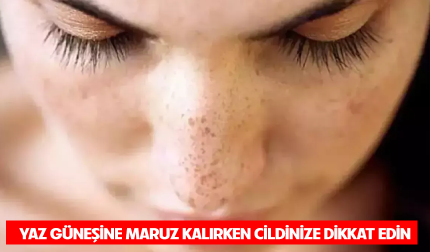 Yaz güneşine maruz kalırken cildinize dikkat edin