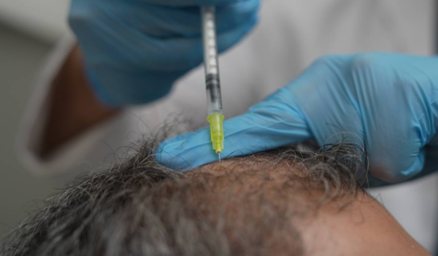 Dökülen saçlar vücudun bir alarmı olabilir