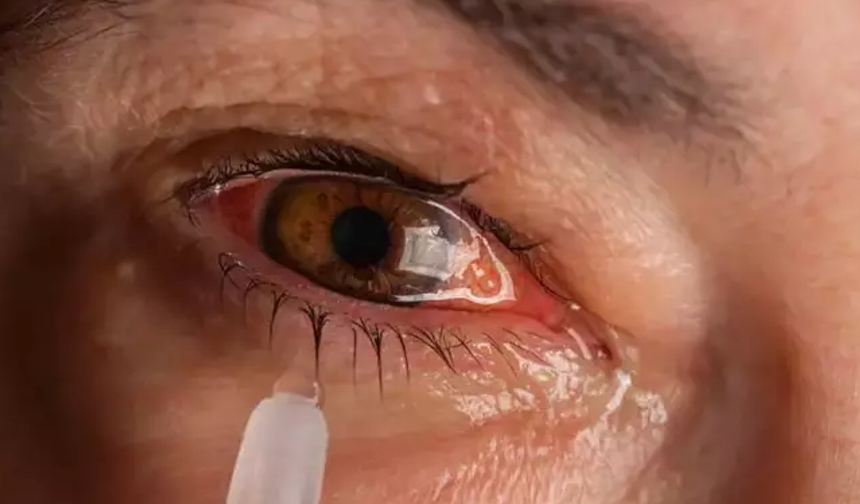 Soğuk hava, klima ve kapalı ortamlar göz enfeksiyonlarını artırıyor