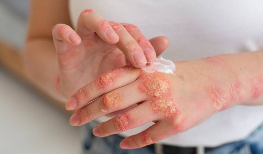 Uzmanından soğuk havalar öncesinde uyarı