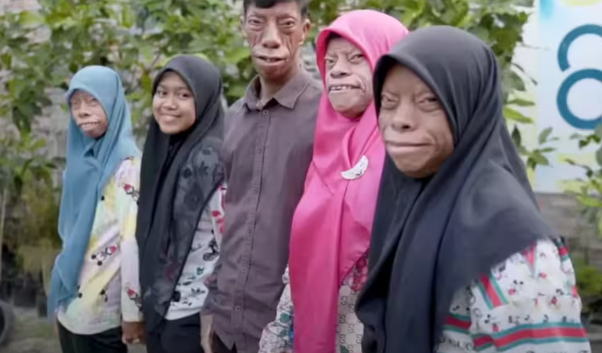 Dünya onları konuşuyor! "Kertenkele Ailesi" kısa sürede fenomen oldu