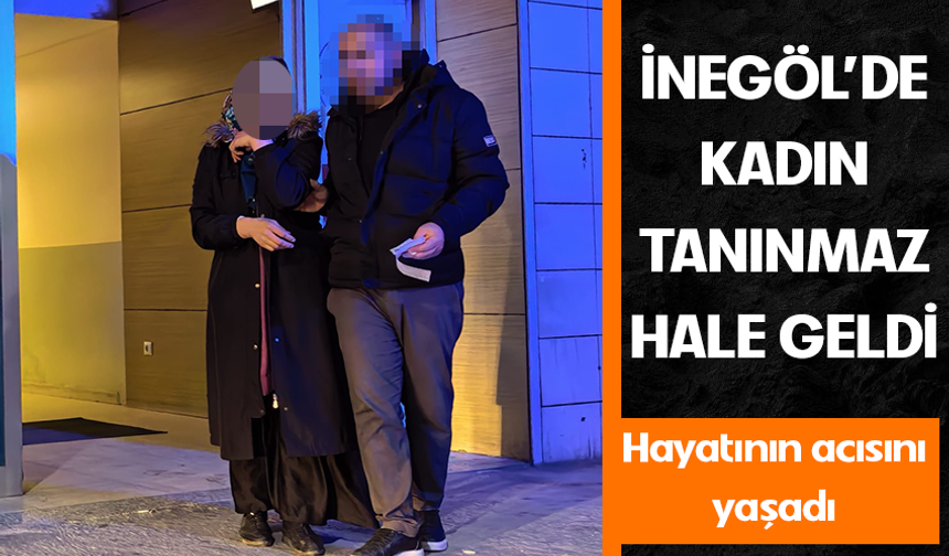 Bursa İnegöl'de kadın tanınmaz hale geldi!