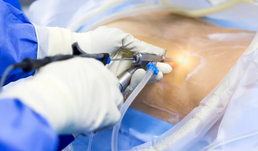 Kapalı omurga cerrahisi hastalara konfor sağlıyor